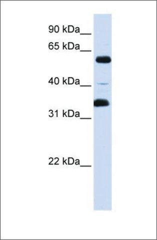 Anti-ZKSCAN1 antibody produced in rabbit