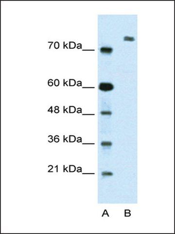 Anti-ZMyM3 (AB2) antibody produced in rabbit