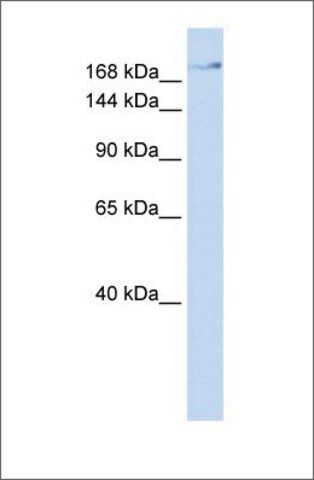 Anti-ZMYM4 antibody produced in rabbit