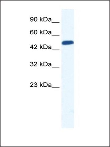 Anti-ZNF239 (AB1) antibody produced in rabbit