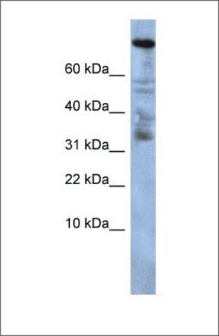 Anti-ZNF251 (ab2) antibody produced in rabbit