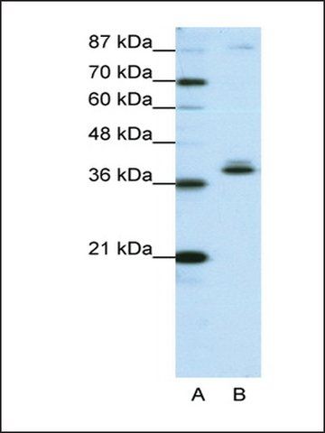 Anti-ZNF25 antibody produced in rabbit