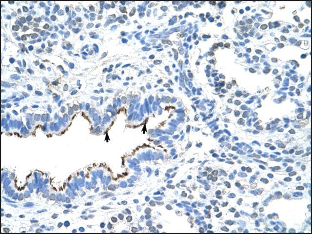 Anti-ZNF239 (AB2) antibody produced in rabbit