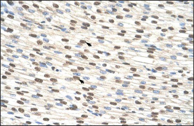 Anti-ZNF274 antibody produced in rabbit