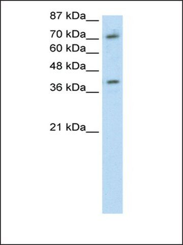 Anti-ZNF282 (AB2) antibody produced in rabbit