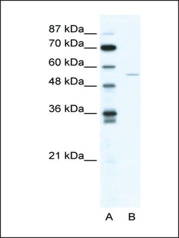 Anti-ZNF289 antibody produced in rabbit