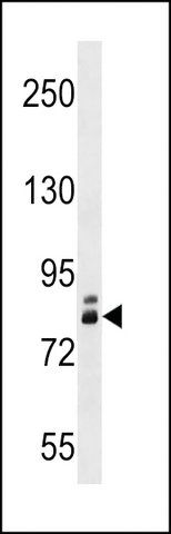 ANTI-ZNF252(N-TERMINAL) antibody produced in rabbit