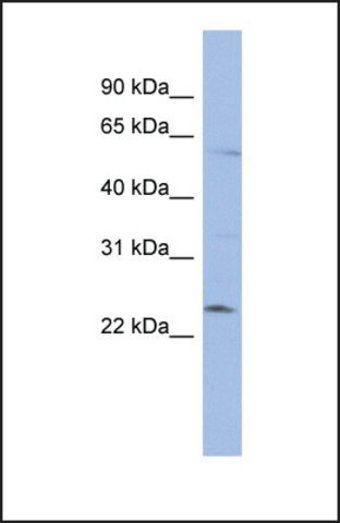 Anti-ZNF239, (N-terminal) antibody produced in rabbit