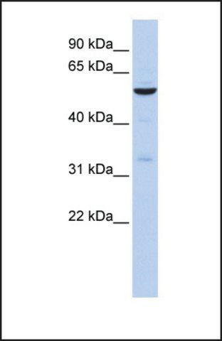 Anti-ZNF266, (N-terminal) antibody produced in rabbit