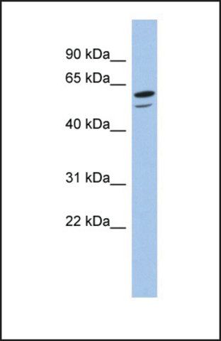 Anti-ZNF248, (N-terminal) antibody produced in rabbit