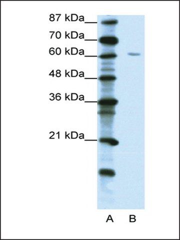 Anti-ZNF286 (AB2) antibody produced in rabbit