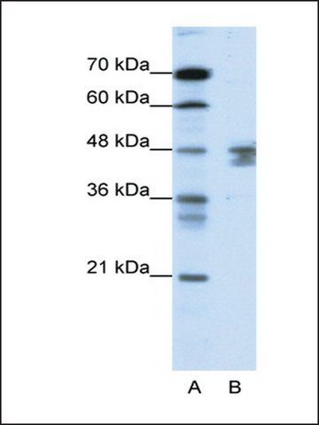 Anti-ZNF271 antibody produced in rabbit