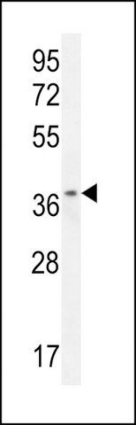 ANTI-ZNF322B (C-TERM) antibody produced in rabbit