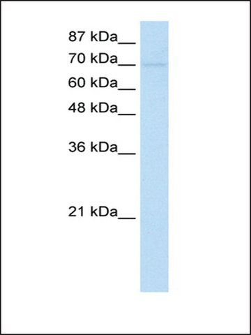 Anti-ZNF282 (AB1) antibody produced in rabbit