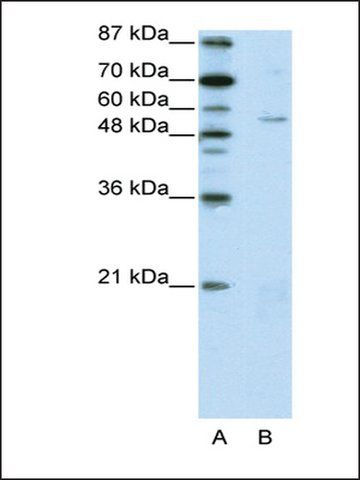 Anti-ZNF329 antibody produced in rabbit