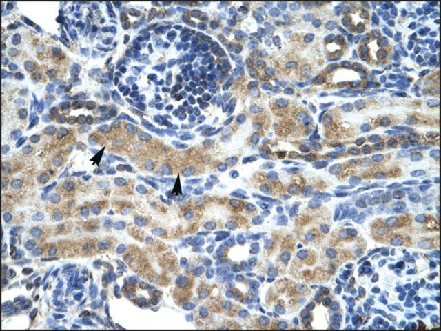 Anti-ZNF24 antibody produced in rabbit