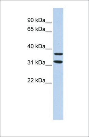 Anti-ZNF254 antibody produced in rabbit