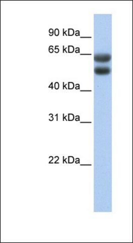 Anti-ZNF331 antibody produced in rabbit