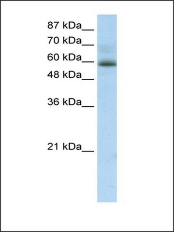 Anti-ZNF307 (AB2) antibody produced in rabbit