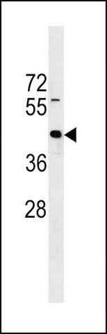 ANTI-ZNF331 (N-TERM) antibody produced in rabbit