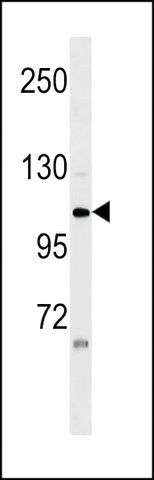 ANTI-ZNF33A(N-TERMINAL) antibody produced in rabbit