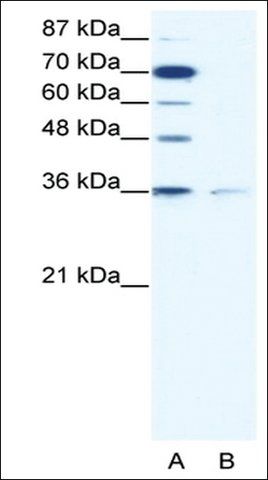 Anti-ZNF326 (AB1) antibody produced in rabbit