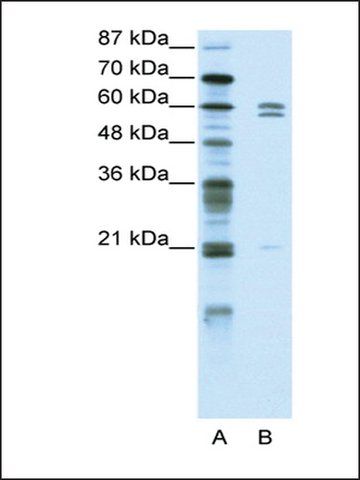 Anti-ZNF312 (AB2) antibody produced in rabbit