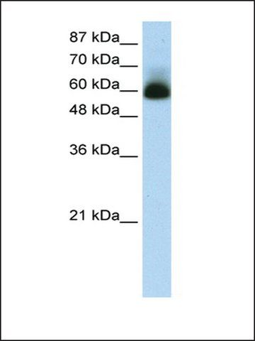 Anti-ZNF307 (AB1) antibody produced in rabbit