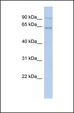 Anti-ZNF319, (N-terminal) antibody produced in rabbit