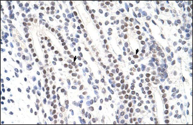 Anti-ZNF342 (AB2) antibody produced in rabbit