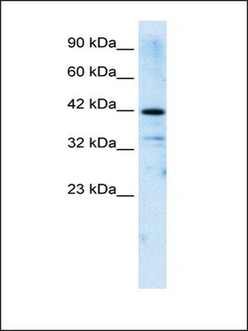 Anti-ZNF323 antibody produced in rabbit