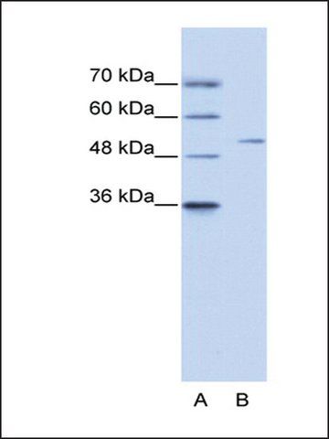 Anti-ZNF555 (AB1) antibody produced in rabbit