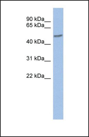 Anti-ZNF565 antibody produced in rabbit