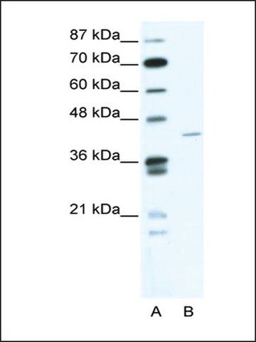 Anti-ZNF568 (AB2) antibody produced in rabbit