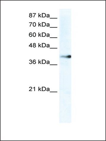 Anti-ZNF556 antibody produced in rabbit