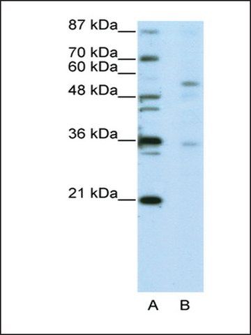 Anti-ZNF57 (AB1) antibody produced in rabbit