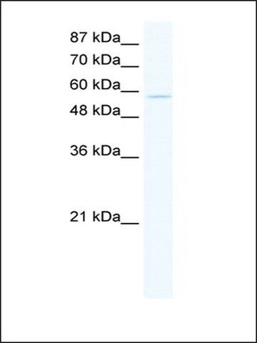 Anti-ZNF559 antibody produced in rabbit