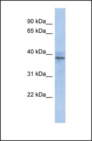 Anti-ZNF625, (N-terminal) antibody produced in rabbit