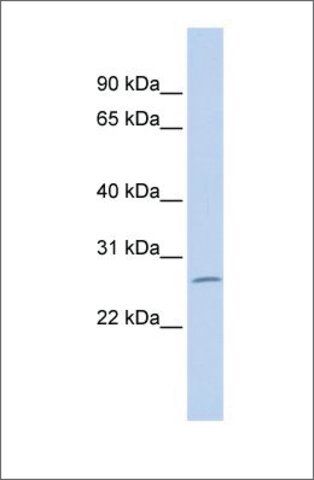 Anti-ZNF575 antibody produced in rabbit