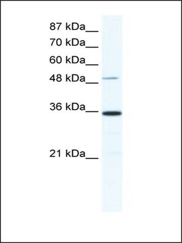 Anti-ZNF610 antibody produced in rabbit