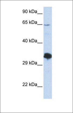 Anti-ZNF630 (ab2) antibody produced in rabbit