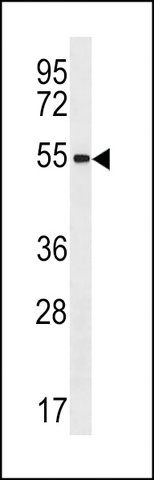 ANTI-ZNF621(N-TERMINAL) antibody produced in rabbit