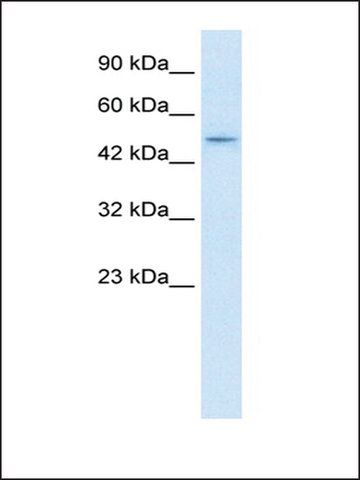 Anti-ZNF651 antibody produced in rabbit