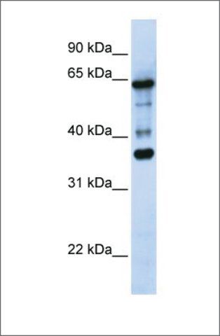 Anti-ZNF630 (ab1) antibody produced in rabbit