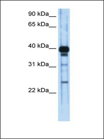 Anti-ZSCAN16 (AB1) antibody produced in rabbit