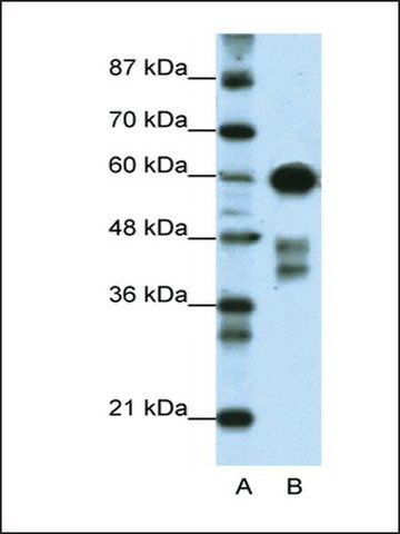 Anti-ZSCAN5 antibody produced in rabbit