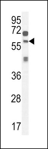 ANTI-ZSWIM1 (C-TERM) antibody produced in rabbit