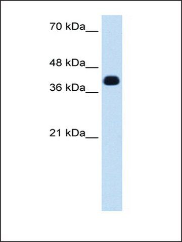 Anti-ZSCAN16 (AB2) antibody produced in rabbit