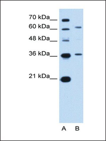 Anti-ZSCAN12 antibody produced in rabbit