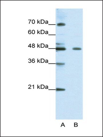 Anti-ZNF645 antibody produced in rabbit